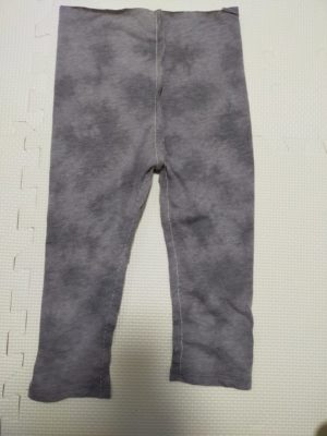 股を縫い合わせたところ